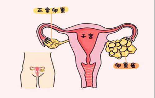 怀孕初期香港验血查男女准吗,不知不觉就怀不上了？附最全男女不孕不育排查