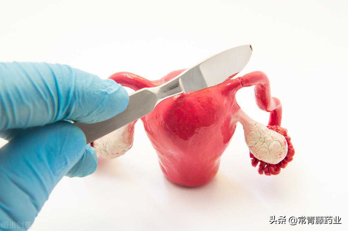 去香港验血看男女,输卵管堵塞合并输卵管水肿，试管前要切除或是结扎？一文