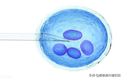 香港验血结果要有几个y,腺肌症患者在什么情况下可以做试管婴儿？