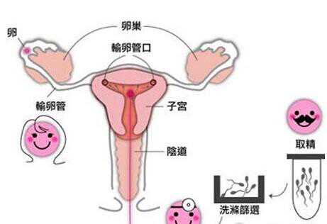 怀孕香港验血需要本人去吗,远离宫外孕，试管婴儿要这样做！