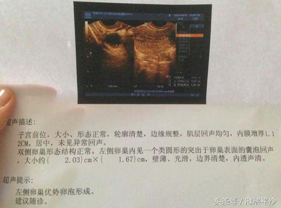 香港验血八大机构,怀孕前的准备：孕前如何快速戒烟